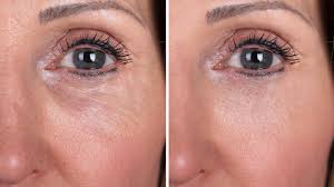 
                  
                    Retinol Under Eye Cream - 2oz
                  
                